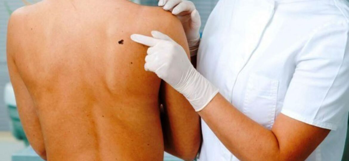 25-visita-dermatologica