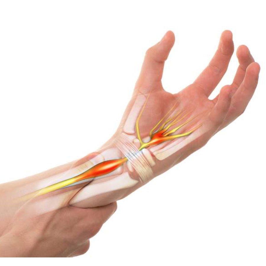 Ortopedico Chirurgo della Mano