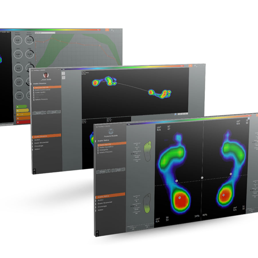 Pedana Baropodometrica